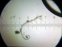 microscopic image of Harposporium anguillulae on a dead nematode