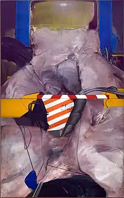 Lifting device (1973)