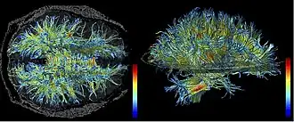 High resolution data acquired on 3-tesla magnet and post-processed using automated tracking procedure.