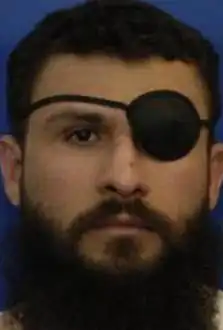 A color photograph, from above the neck, of a bearded young man with an eyepatch over his right eye