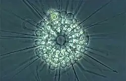 Actinophrys sol, living heliozoon