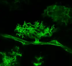 An arbuscular mycorrhizal fungus under fluorescent staining