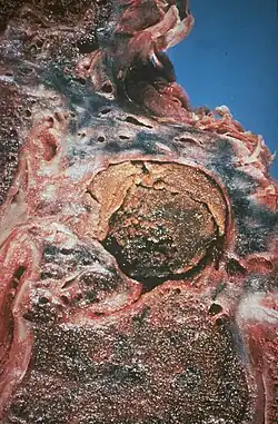 Image of an opened surgical specimen.
