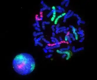 Fluorescence microscopy images of sun flares pathology in a blood cell showing the affected areas in red