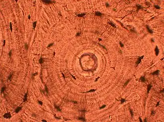 In histopathologic architecture, a whorled pattern consists of multiple concentric objects, or a spiral-shaped pattern. Bone tissue is shown.