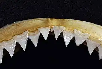 Upper teeth