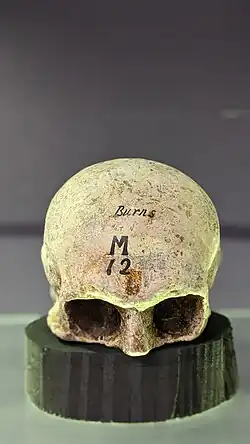 Cast of the skull of Scottish poet Robert Burns (front) - held at the Anatomical Museum, Edinburgh.