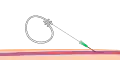 Step 2