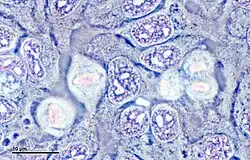 The photo depicts a culture of HeLa cells. They are stained in a light blue-purple color and seem to be in different phases of division. They look like abnormally shaped circles and are all squished in next to each other.