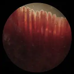 Gills
