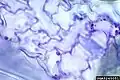 Fig. 2 Cucumber mosaic virus inclusion bodies