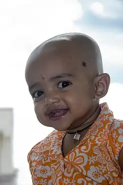 Image 7A Hindu girl after her Karnavedha rite of passage (ear piercing) (from Samskara (rite of passage))