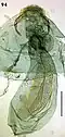 Female genitalia