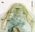 Female terminal abdominal segment