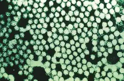 Electron micrograph of Foot-and-mouth disease virus