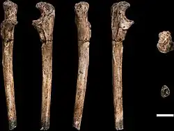 Views of one ulna