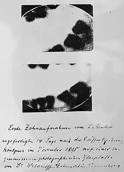 Walkhoff's early dental radiograph experiment