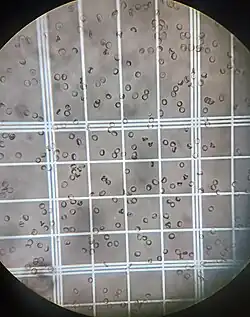Blood RBCs seen using Neubauer type haemocytometer