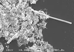 The SOS response inhibits septum formation until bacterial DNA can be repaired[citation needed] and is observable as filamentation when cells are examined by microscopy[citation needed] (top right of image).