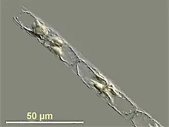 Guinardia delicatula, a diatom responsible for algal blooms in the North Sea and the English Channel[25]