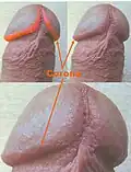 Corona of glans penis