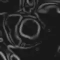 Gradient magnitude image