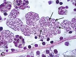 Haplosporidium species infect a variety of invertebrates