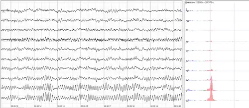 The sample of human EEG with prominent alpha-rhythm in occipital sites