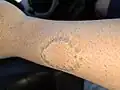 Immediately after