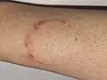 2 days of evolution
