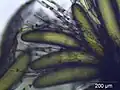 Magnified view of developing antheridia in Hypnum cupressiforme