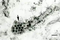 TEM micrograph