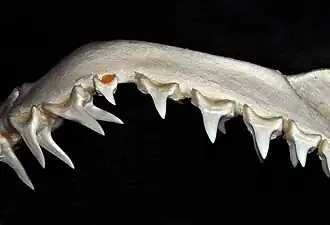 Upper teeth