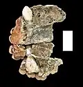 Burial 3 - Abnormal growth of the canines.