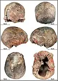 Burial 14 - Cranium