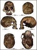 Burial 17 - Cranium
