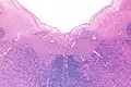 Micrograph of the posterior portion of the open part of the medulla oblongata, showing the fourth ventricle (top of image) and the nuclei of CN XII (medial) and CN X (lateral). H&E-LFB stain.