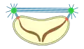 closed extranuclear pleuromitosis
