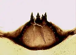 Mouth part of a blackfly larva of Prosimulium sp., 400x