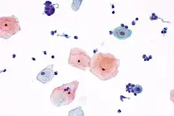 High magnification view