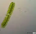Netrium oblongum.&nbsp; A saccoderm "desmid"