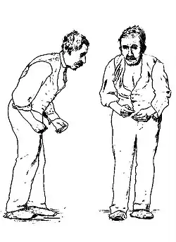 an illustration of two identical men right next to each other, who suffer from Parkinson's