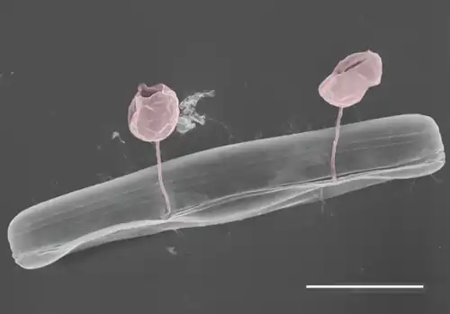 Pennate diatom from an Arctic meltpond, infected with two chytrid-like fungal pathogens (in false-colour red).[98] Scale bar = 10 μm.