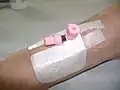 The catheter in between uses.