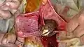Leg of fetal lamb appearing out of the uterus during caesarean section