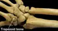 Right hand posterior view (dorsal view). Thumb on bottom.