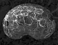 Electron micrograph of a poppy seed