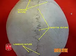Skull seen from top. Sagittal suture separates left and right parietal bone.