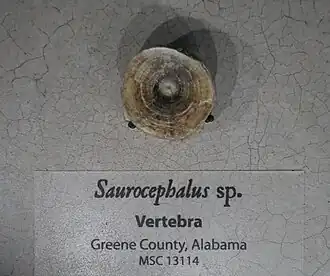 Vertebra