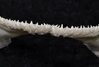 Lower teeth